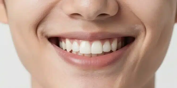 Natural Ways to Whiten Teeth