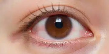 Dry Eyes During Pregnancy
