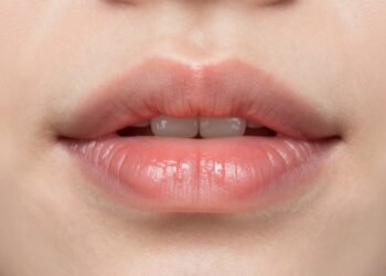 White Patch on Lips