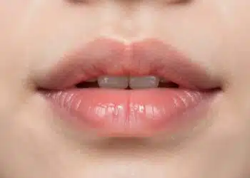 White Patch on Lips