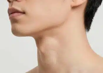How to Get Rid of Fat Neck