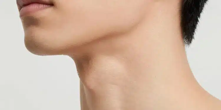 How to Get Rid of Fat Neck
