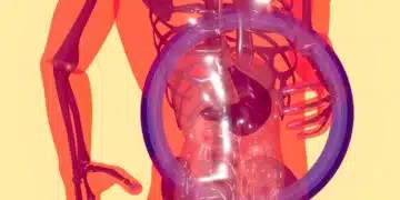 Acid Reflux at Night
