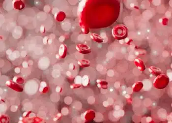 High Cholesterol Symptoms