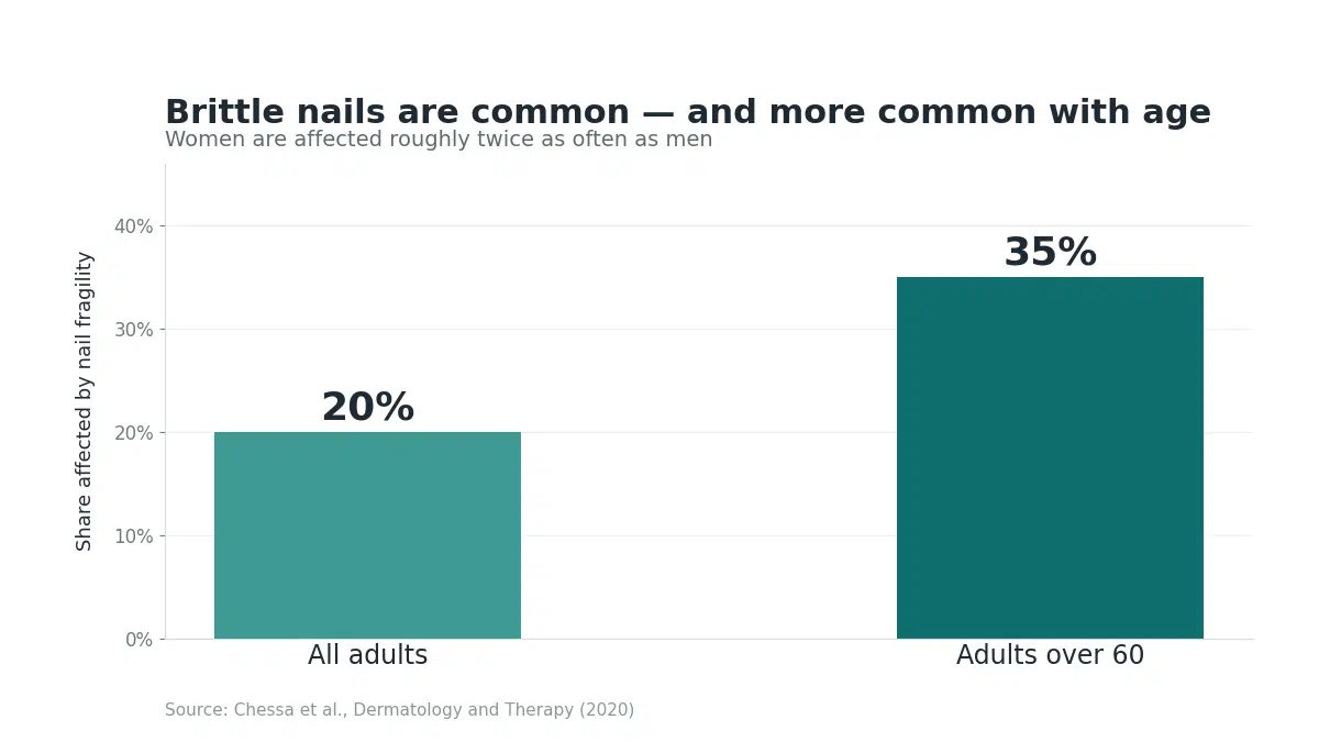 Bar chart showing brittle nails affect about 20% of adults and 35% of people over 60