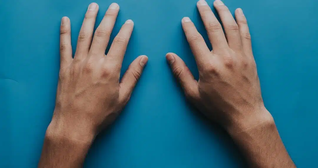 Cold Hands