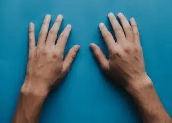 Cold Hands