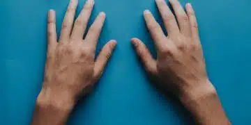 Cold Hands