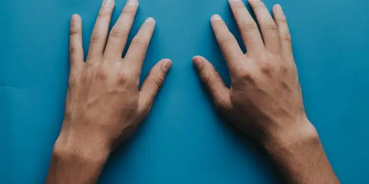 Cold Hands