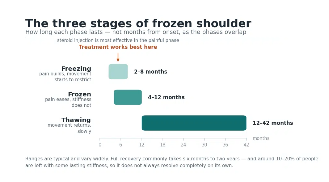 Timeline chart of the three frozen shoulder stages: freezing 2 to 8 months, frozen 4 to 12 months, thawing 12 to 42 months