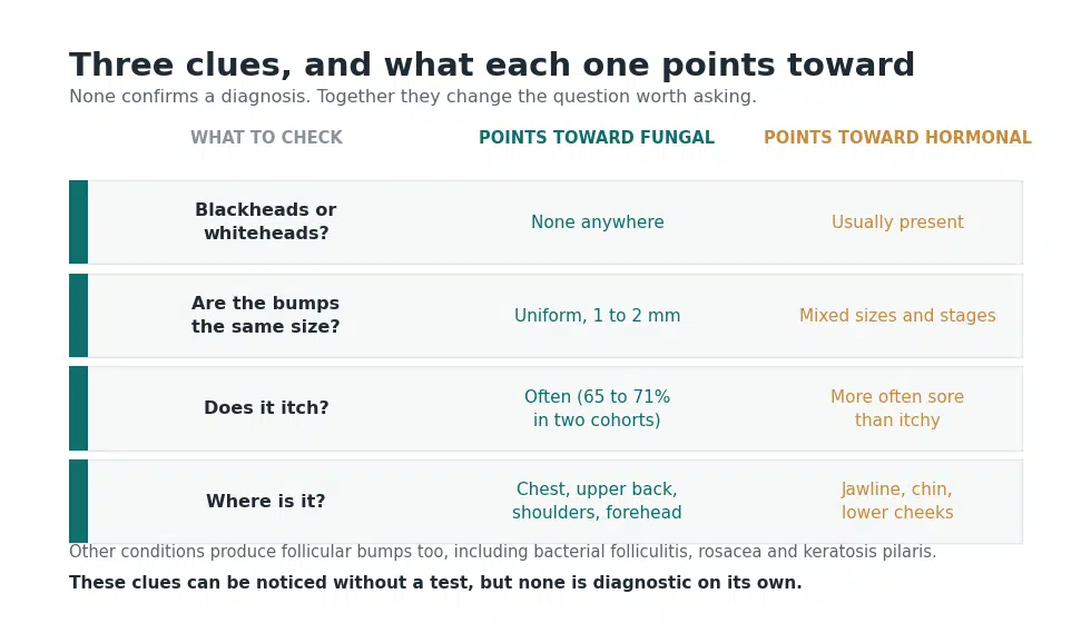 Comparison chart of fungal acne and hormonal acne by presence of comedones, bump uniformity, itching and location on the body