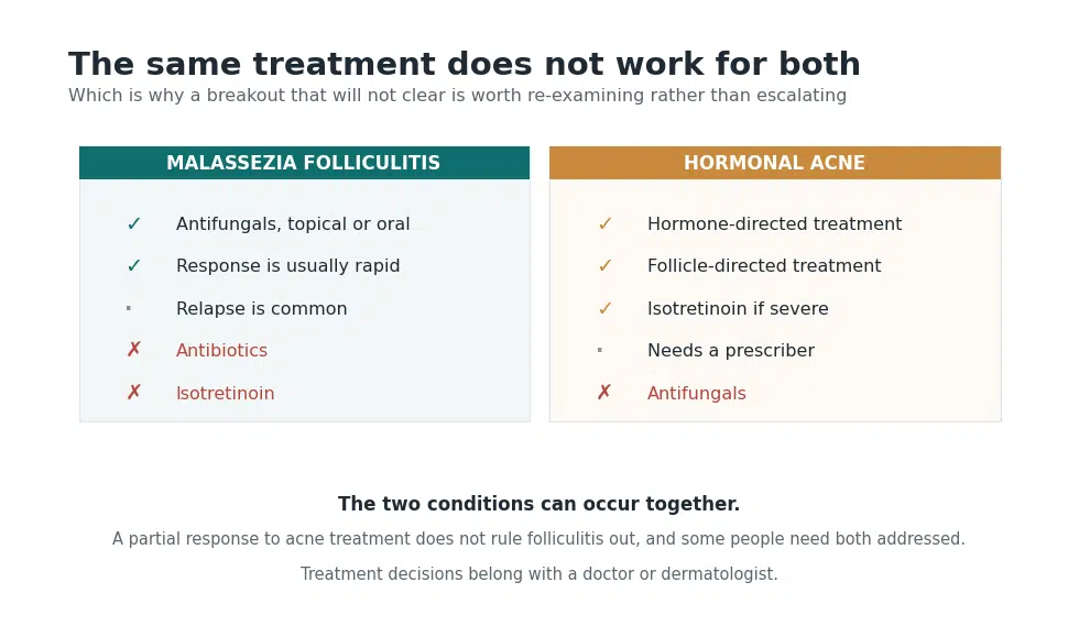 Chart showing antifungals treat Malassezia folliculitis while antibiotics and isotretinoin do not, and antifungals do not treat hormonal acne