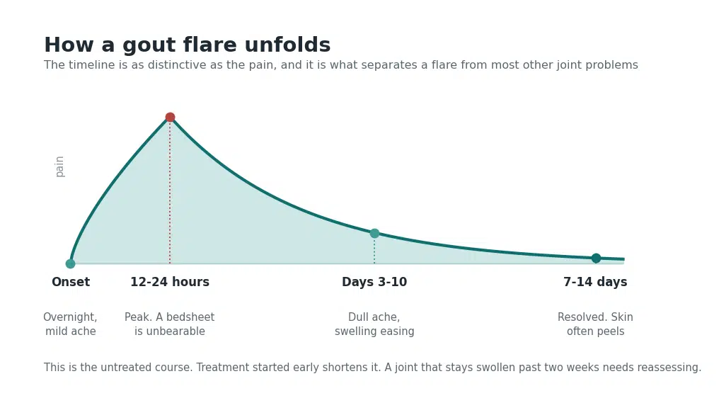 Timeline of gout symptoms from night onset through the 12 to 24 hour peak to resolution over one to two weeks