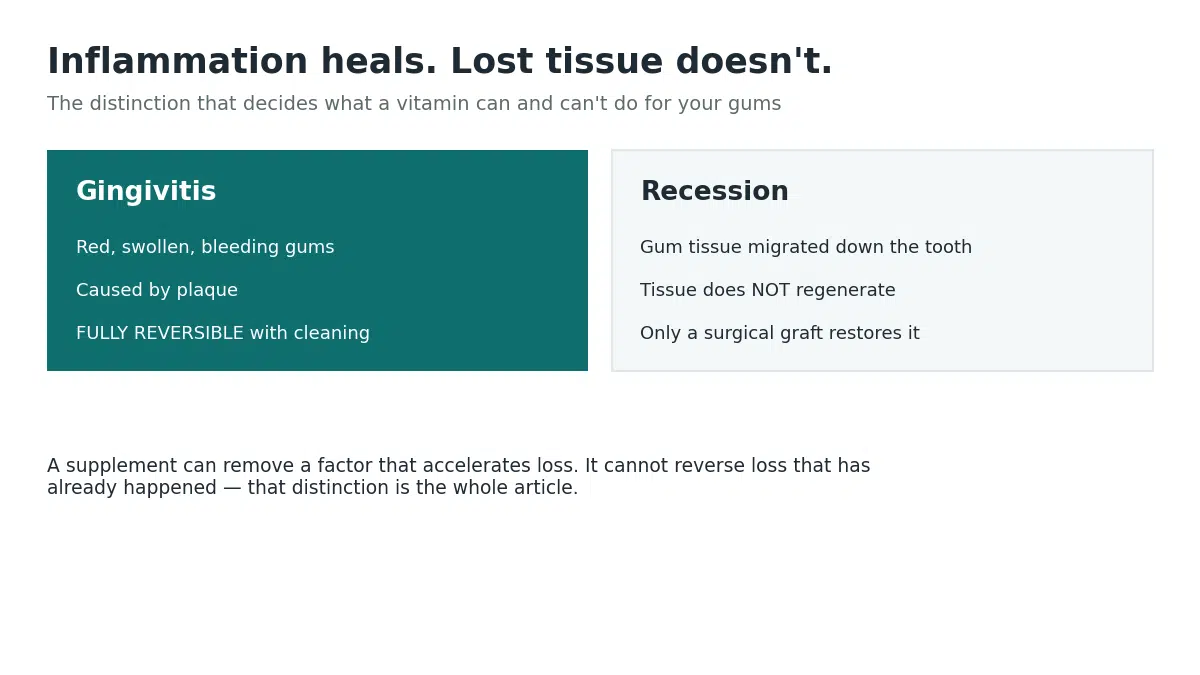 Gingivitis is fully reversible with cleaning, but gum recession is permanent tissue loss that only a surgical graft can restore