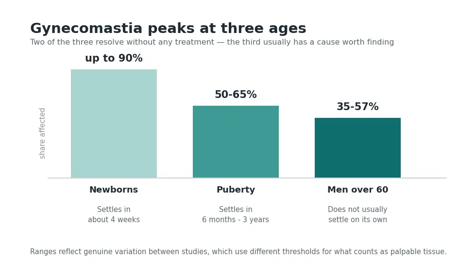 Chart of gynecomastia prevalence at three life stages, newborns, puberty and men over 60, with resolution times