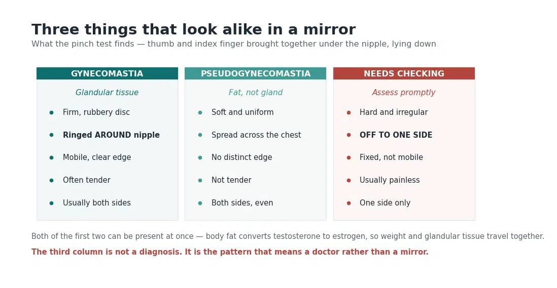 Comparison of gynecomastia, pseudogynecomastia and male breast cancer by texture, position relative to the nipple, and tenderness