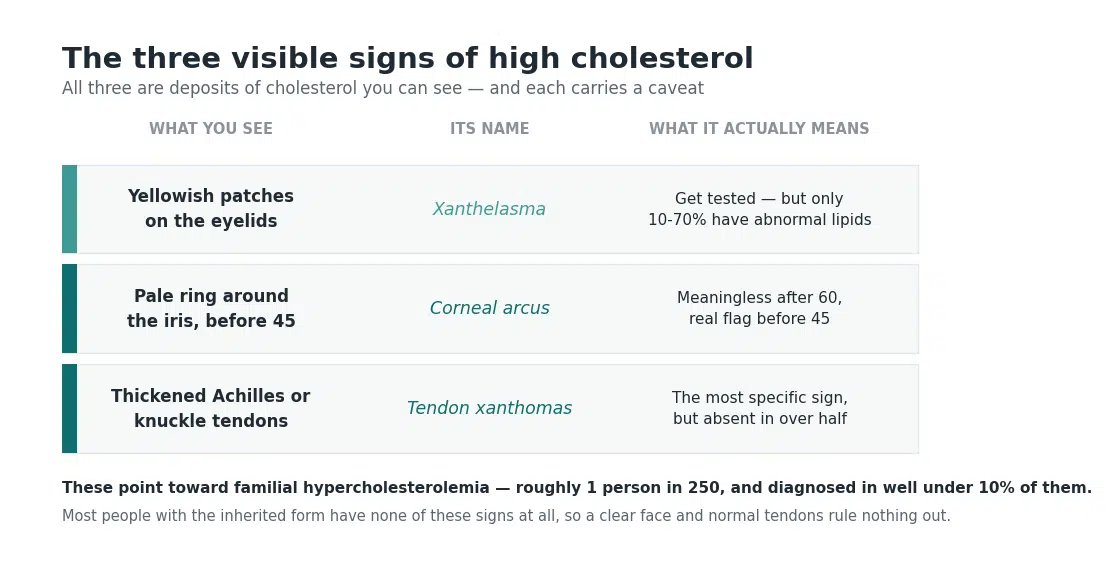 Chart of the three visible signs of high cholesterol and what each one means, with the age at which each becomes meaningful