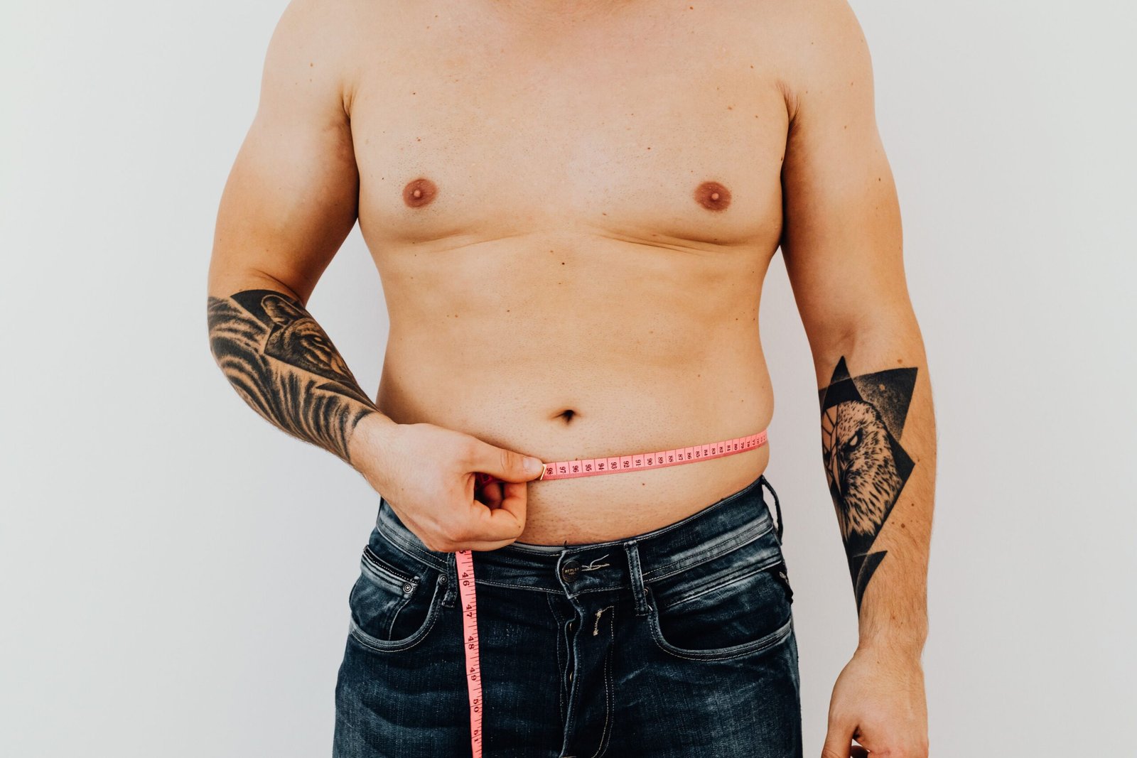 Gynecomastia
