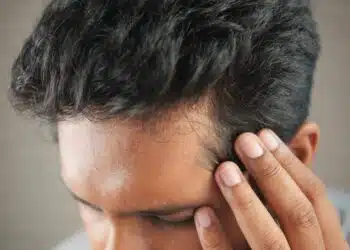 Creatine Hair Loss