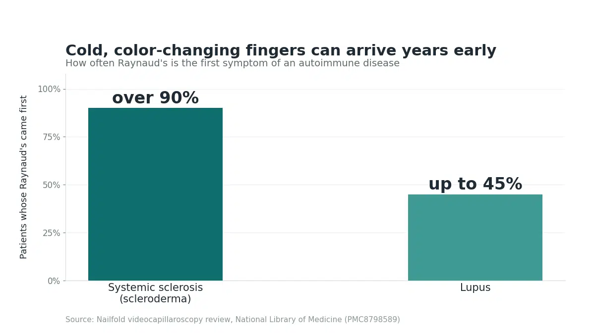 Chart showing cold hands and feet from Raynaud's are the first symptom in over 90% of systemic sclerosis cases