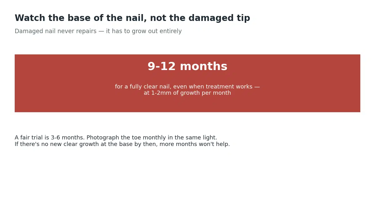 A fully clear toenail takes 9 to 12 months to grow out even when treatment works, so watch for new clear growth at the base rather than improvement in the damaged tip
