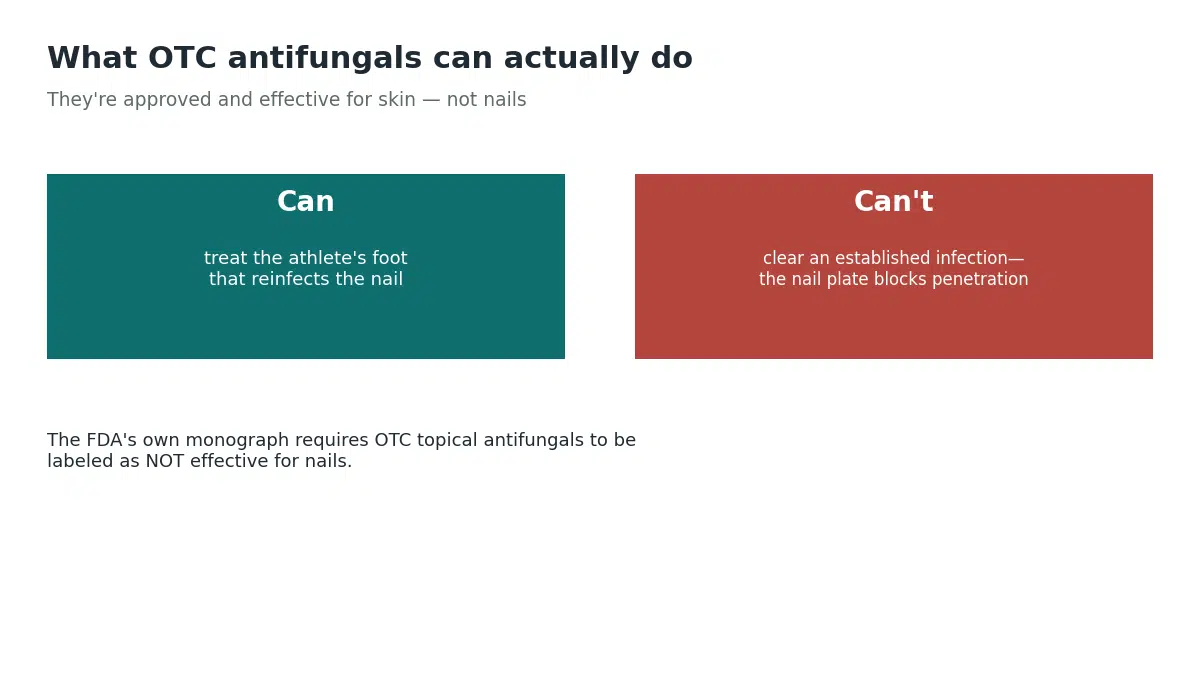 Over-the-counter antifungals can treat the athlete's foot that reinfects the nail, but cannot clear an established nail infection because the nail plate blocks penetration